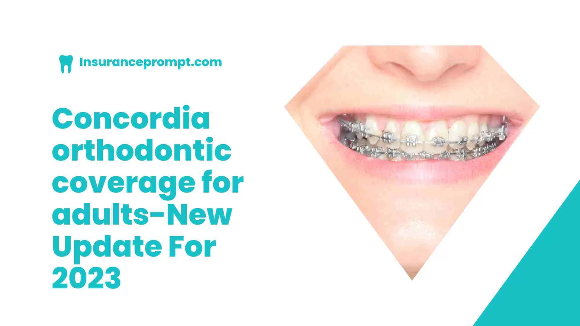 Concordia orthodontic coverage for adults