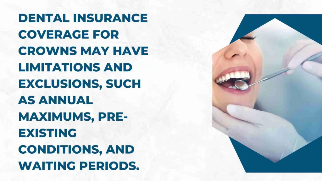 Limitations And Exclusions Of Dental Insurance Coverage For Crowns